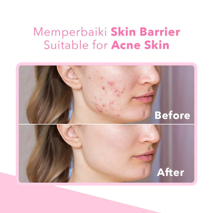 FAV Beauty Moisturizer 7x Ceramide dan Niacinamide